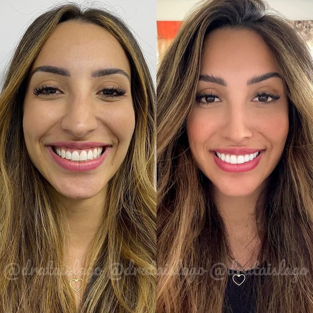 Snapinsta.app_273843914_315431347223222_7541437302909482331_n_1080