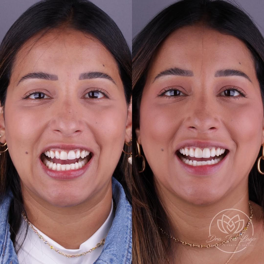 Snapinsta.app_279148518_2731355203674843_2833402582131672435_n_1080