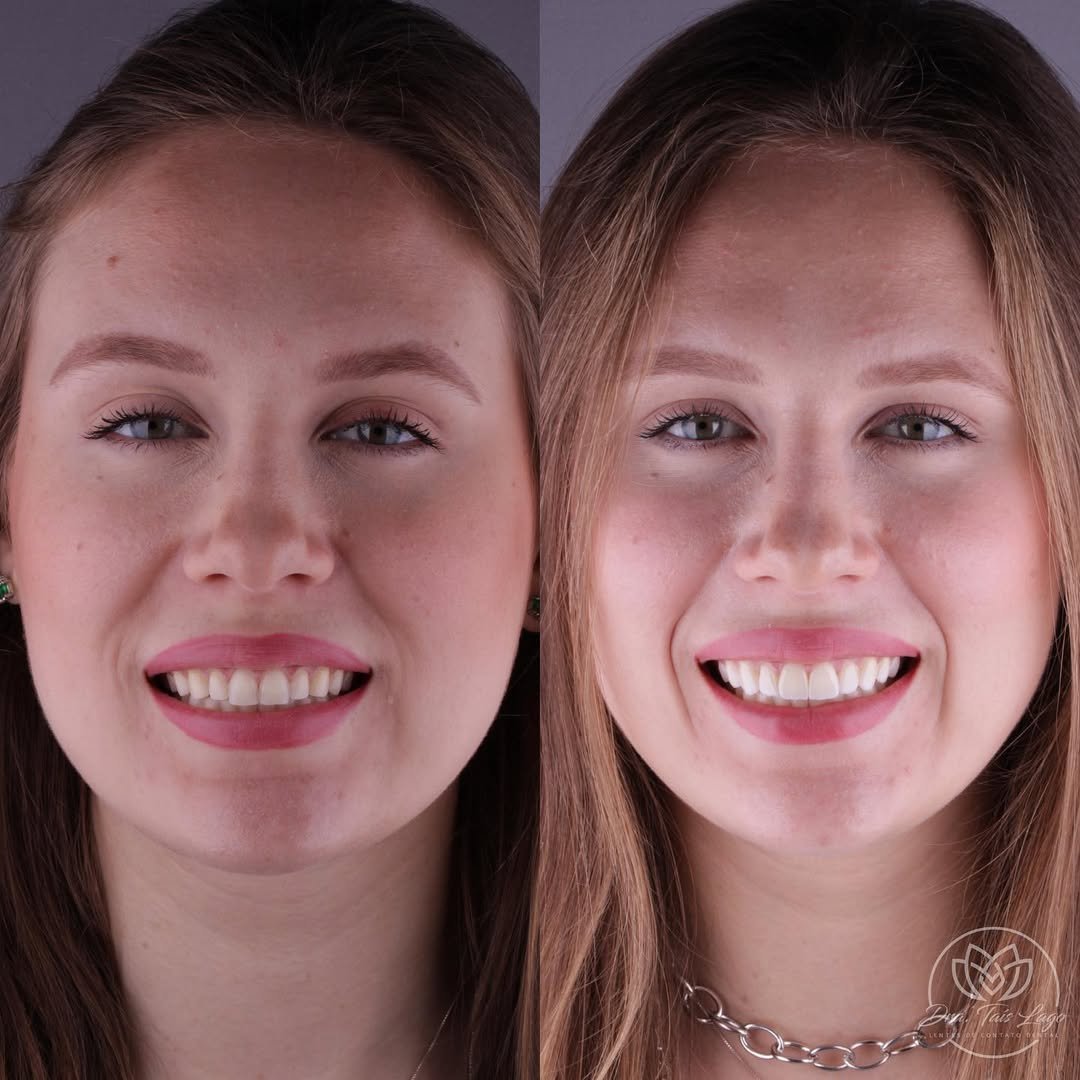 Snapinsta.app_340018681_5873589676085686_2754849577796594017_n_1080